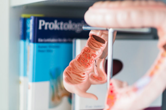 Proktologe In Der Nähe Online Termin Enddarmsprechstunde - Proktologie : gastroenterologie-lehrte.de
